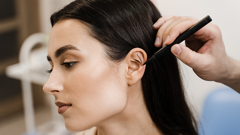 Ear correction surgery