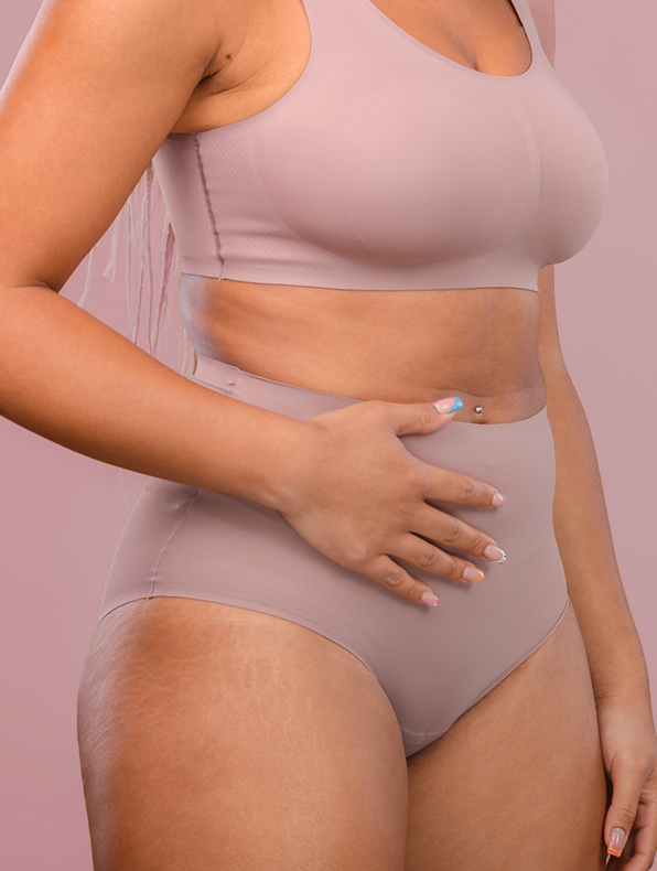 Tummy Tuck