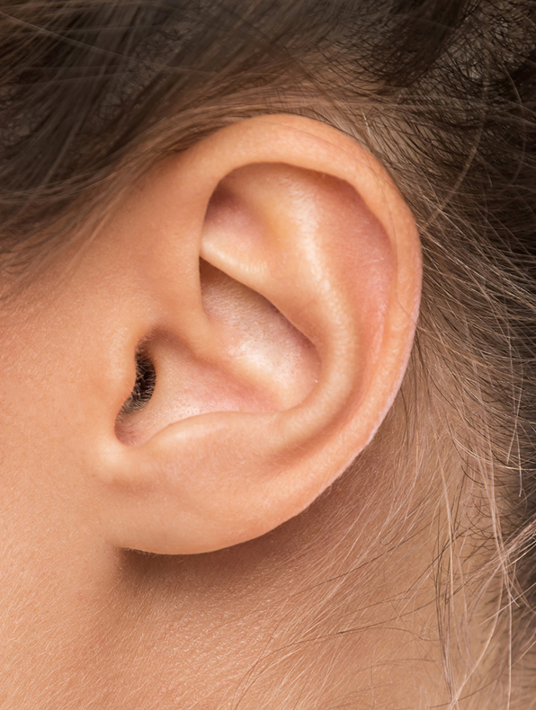 Ear correction surgery